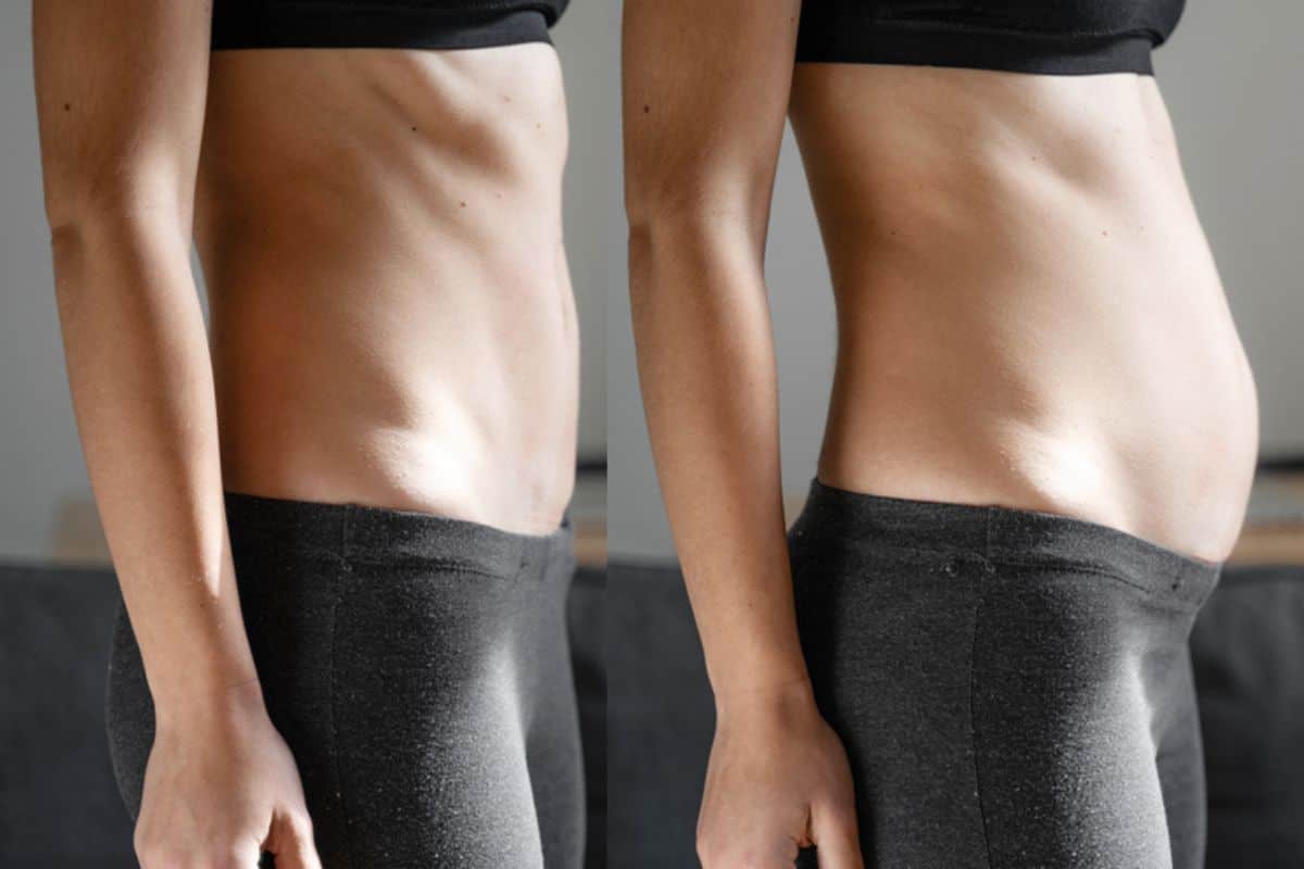How long does diastasis recti take to improve Avon?