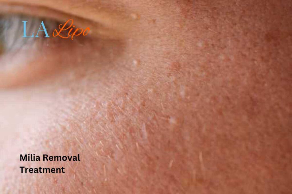 When It’s Time to See a Professional Avon?