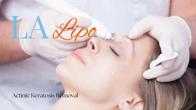 Woman receiving Actinic Keratosis Removal Treatment Avon