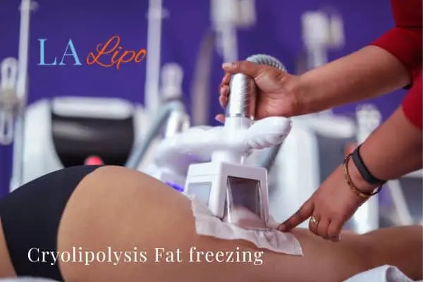 women getting fat freezing Avon