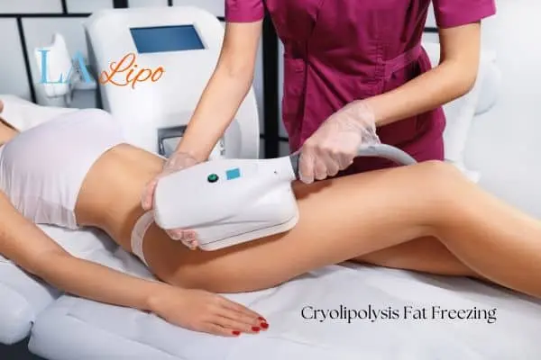 Woman receiving coolsculpting Avon treatment on her thighs