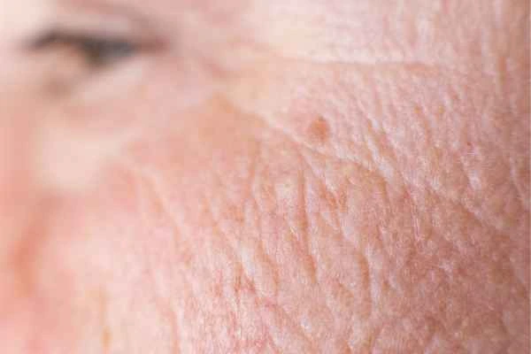close up picture of a woman's face showing an age spot Avon