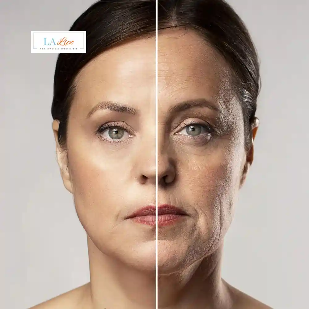 How Can You Tell If Non-Surgical Skin Tightening Is Right for You Avon?