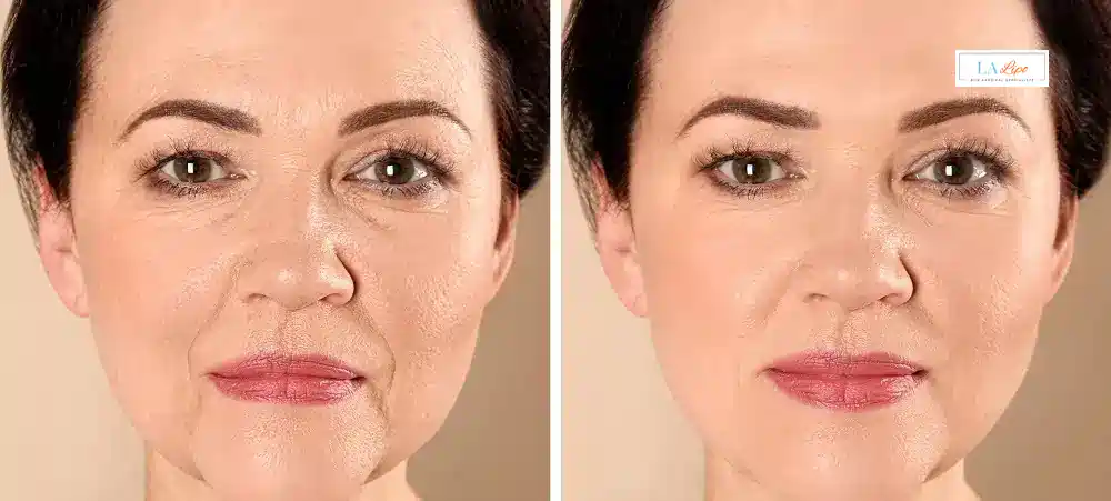 How Long Does It Take to See Results and How Long Do They Last Avon?