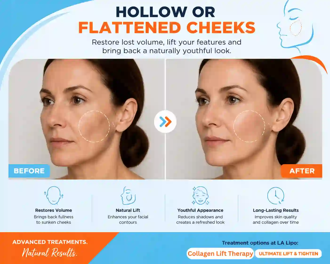 Sign #4: Hollow or Flattened Cheeks Avon