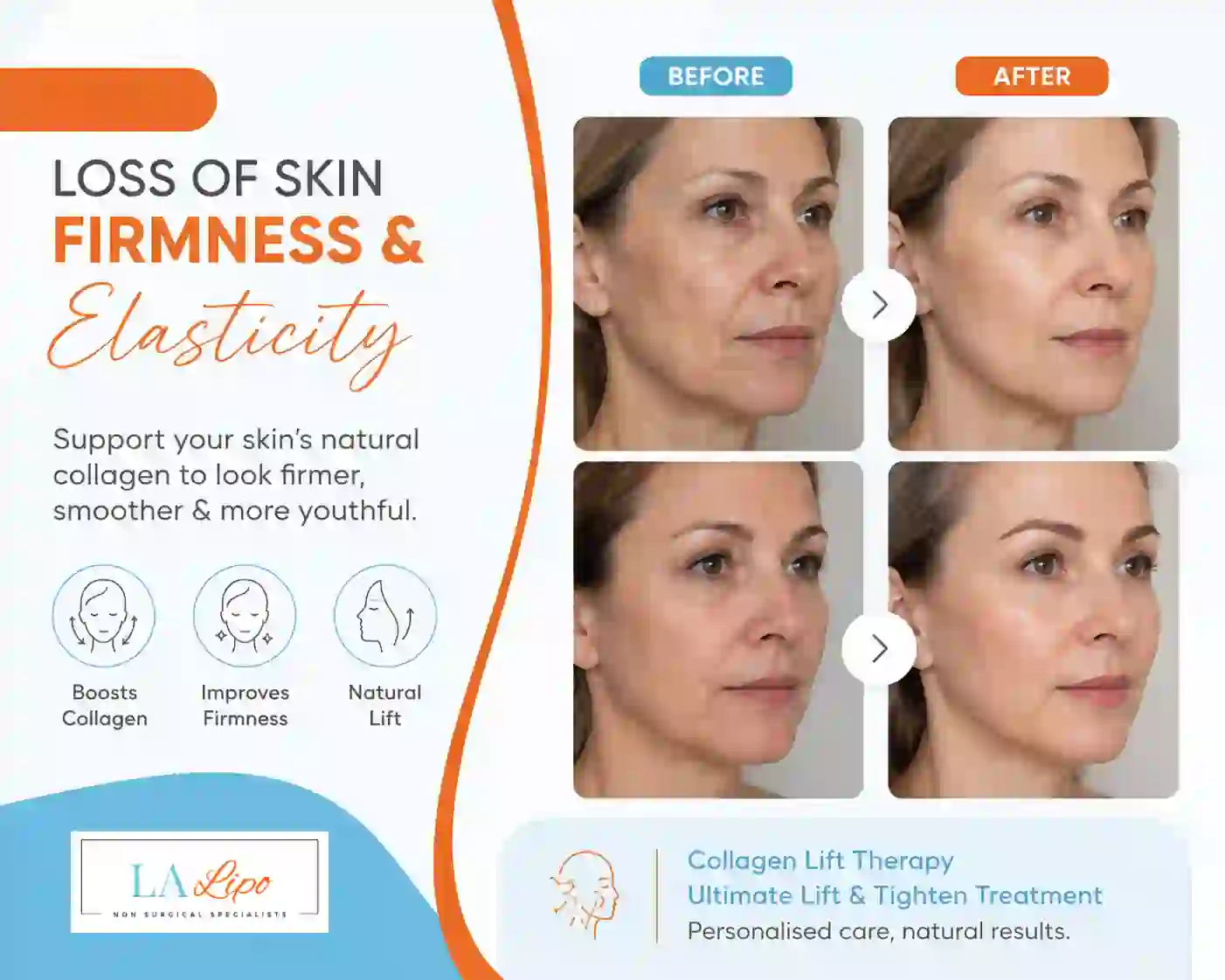 Sign #7: Loss of Skin Firmness and Elasticity Avon